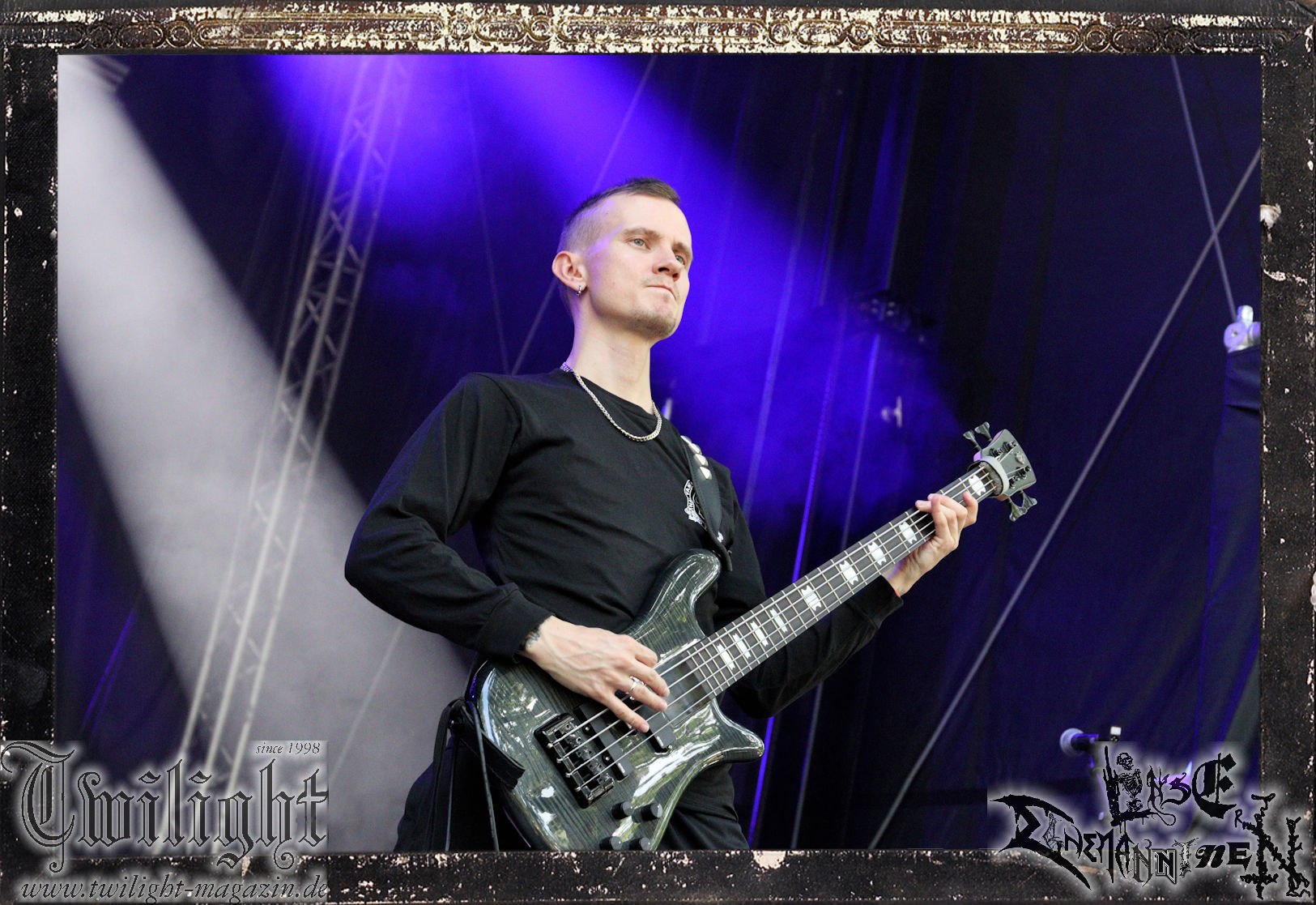 Epicardiectomy 05 07 27 2024 11 05 AM